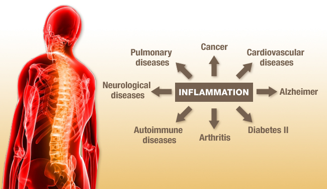 56. Inflammation